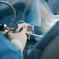 Chirurg wykonuje artroskopię biodra, używając specjalistycznego sprzętu do precyzyjnej operacji.
