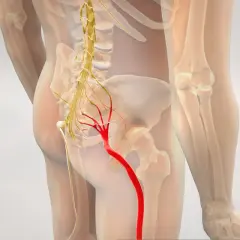 Anatomia bólu: czerwony nerw kulszowy, który może powodować rwę kulszową. RTG nie pokaże bezpośrednio tego problemu.