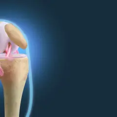 Anatomia kolana z widocznymi więzadłami. Ilustracja pokazuje, jak zerwane więzadła w kolanie objawy mogą być widoczne w uszkodzeniu.