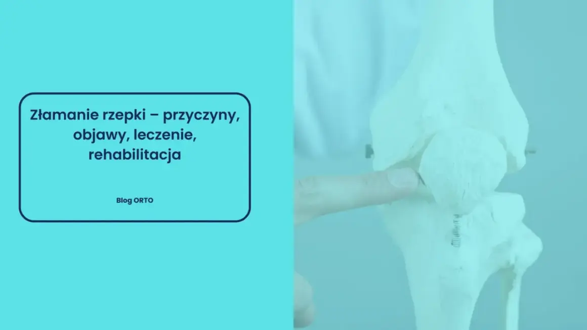 Model kolana z widocznym uszkodzeniem rzepki, wskazującym na złamanie. Tekst informuje o przyczynach, objawach i leczeniu.