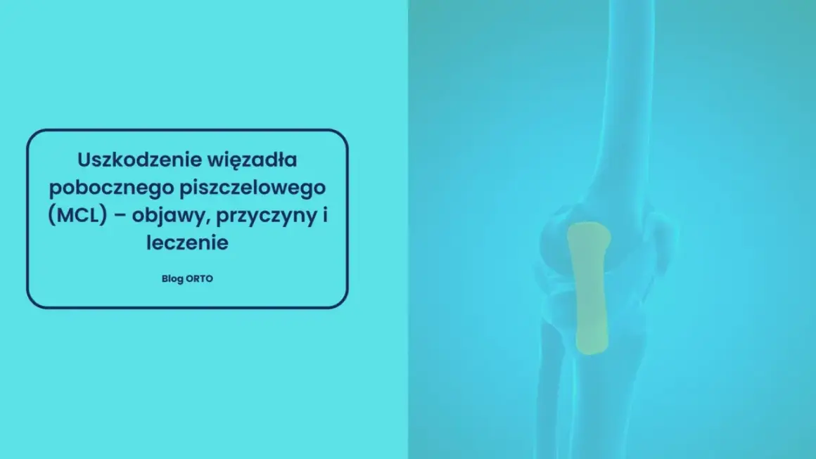 Ilustracja przedstawia uszkodzenie więzadła pobocznego piszczelowego (MCL) w stawie kolanowym.