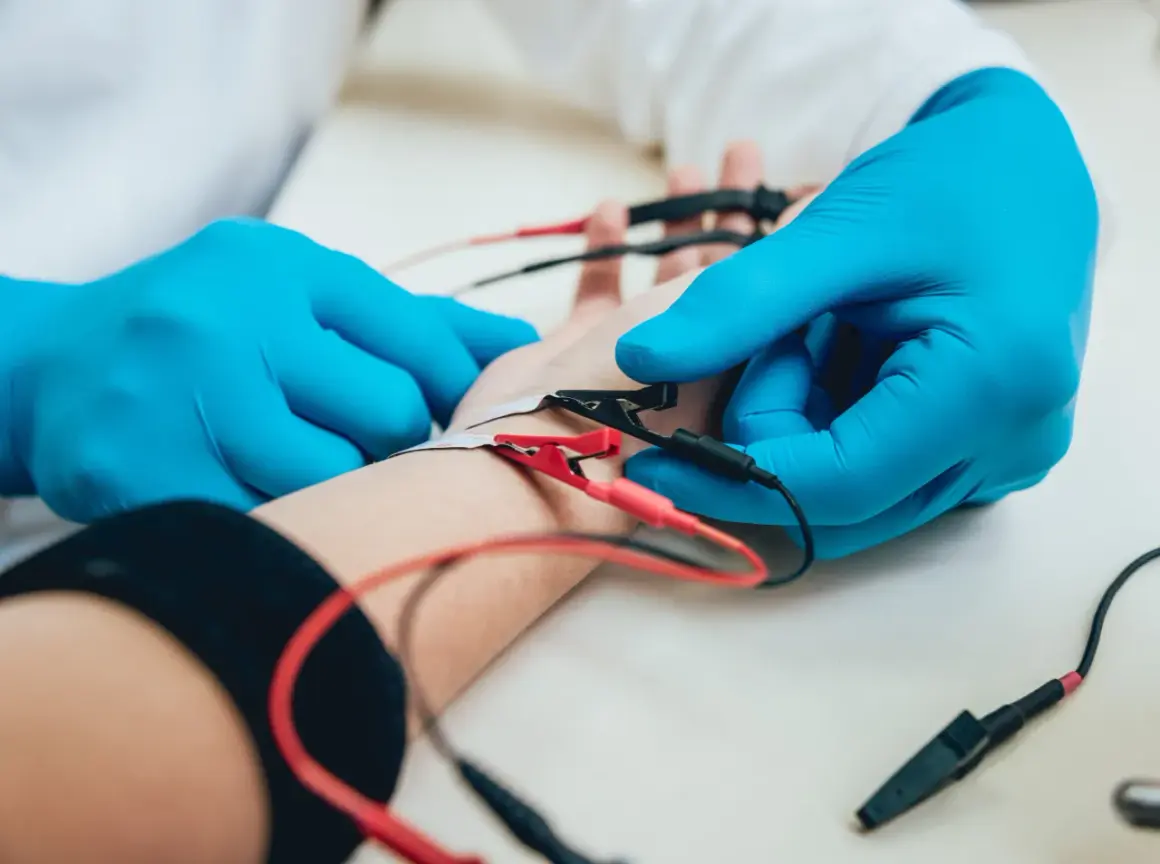 Badanie EMG, czyli elektromiografia, to badanie oceniające aktywność elektryczną mięśni. Na zdjęciu widać elektrody podłączone do przedramienia pacjenta.