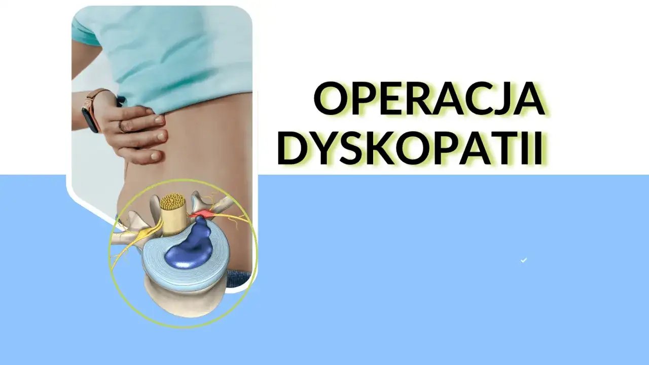 Operacja dyskopatii szyjnej - kiedy ma sens i ile kosztuje?