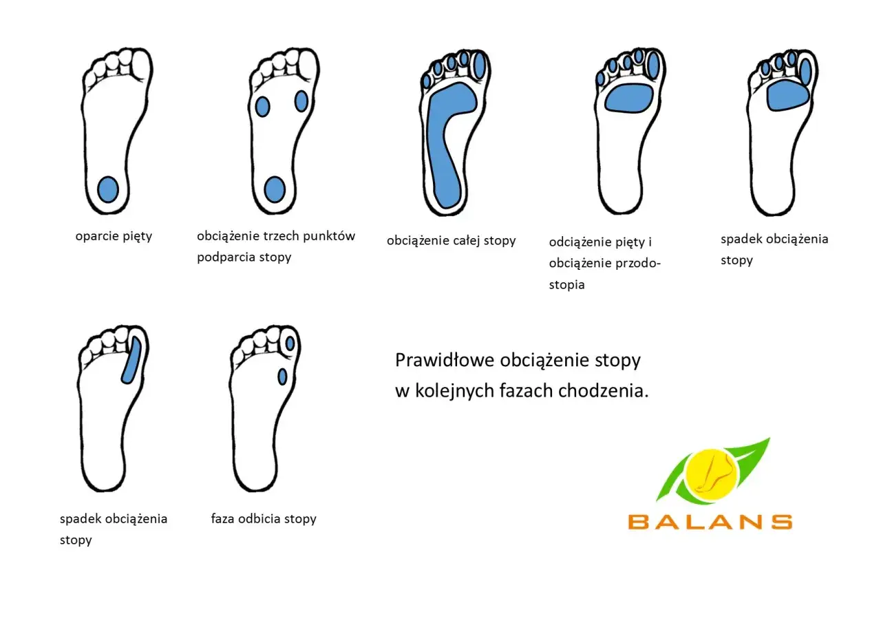 Ilustracja pokazuje prawidłowe obciążenie stopy w różnych fazach chodzenia, od oparcia pięty po odbicie. Unikaj plaskostopie poprzeczne.