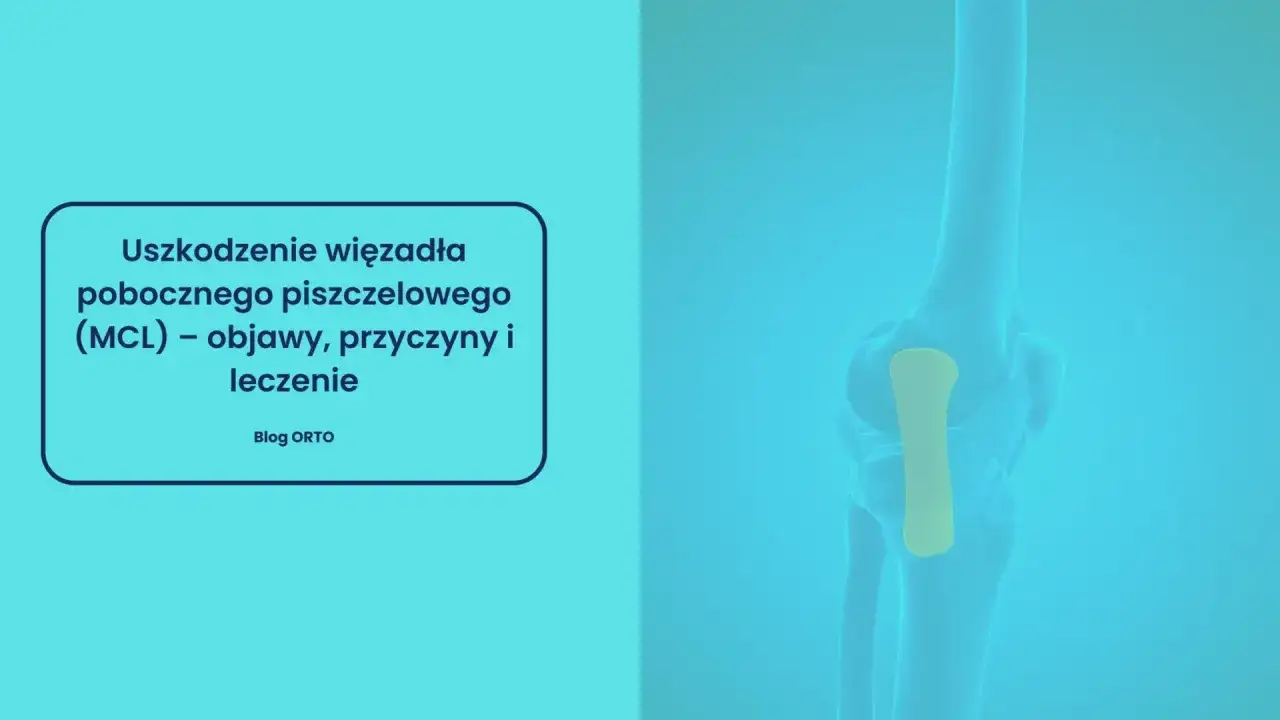 Anatomia kolana z zaznaczonym więzadłem pobocznym przyśrodkowym (MCL). Tekst informuje o uszkodzeniu MCL.