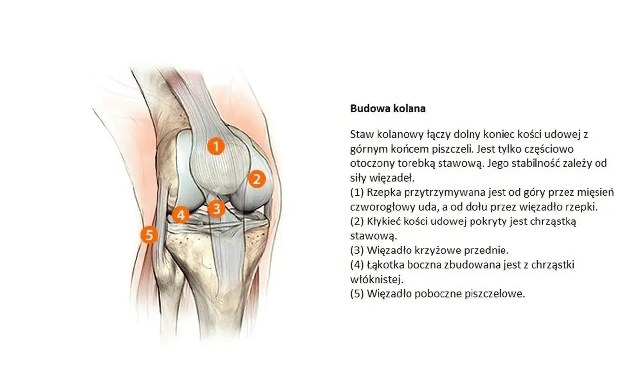 Anatomia kolana: zrozumienie, co to jest chondromalacja, dzięki schematowi stawu kolanowego z zaznaczonymi elementami: rzepką, kłykciem kości udowej, więzadłem krzyżowym przednim, łąkotką boczną i więzadłem pobocznym.