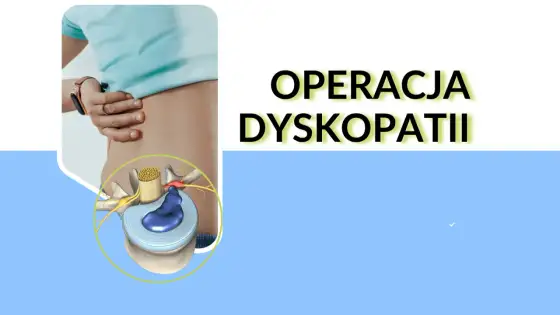 Operacja dyskopatii szyjnej - kiedy ma sens i ile kosztuje?