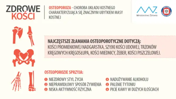 Osteoporoza: jak leczyć? Infografika o zdrowych kościach, złamaniach osteoporotycznych i czynnikach ryzyka.