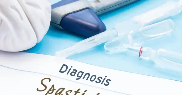 Medyczne narzędzia i ampułki na niebieskim tle. Na papierze widnieje napis "Diagnosis Spastyczność mięśni".
