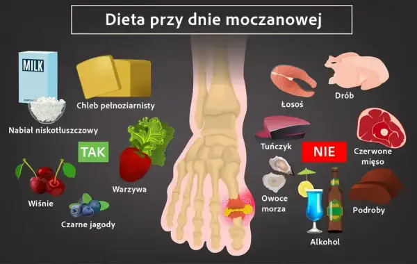 Dieta przy dnie moczanowej: tak dla nabiału, wiśni, jagód, warzyw. Unikaj czerwonego mięsa, podrobów, owoców morza, alkoholu, by zapobiec guzki dnawe.