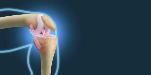 Anatomia kolana z widocznymi więzadłami. Ilustracja pokazuje, jak zerwane więzadła w kolanie objawy mogą być widoczne w uszkodzeniu.